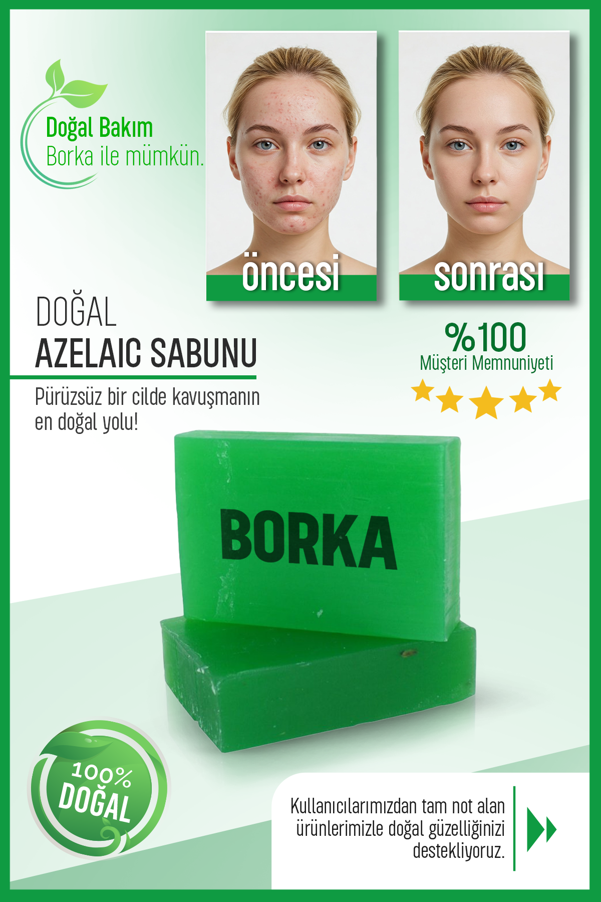 Doğal Azelaik Asit Sabun