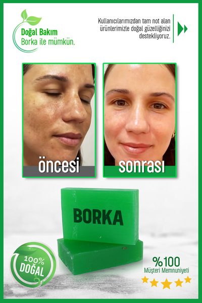Doğal Azelaik Asit Sabun